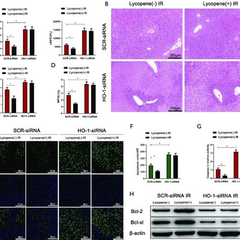 Ho Knockdown In Kupffer Cells Kcs Exacerbates Ir Induced Acute