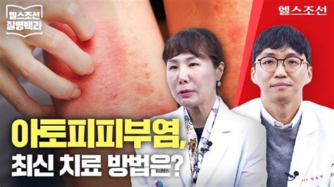 아토피피부염 표적 치료제로 효과적 치료 가능해져 질병백과 Youtube