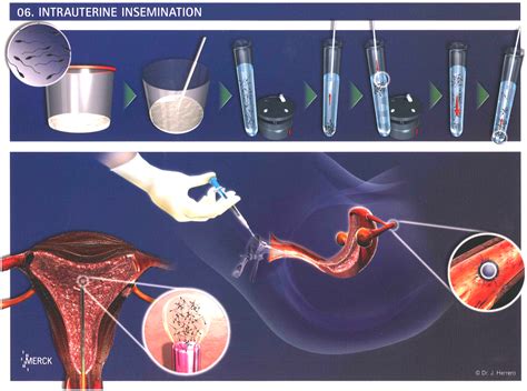 Hong Kong Fertility Technologyandprenatal Diagnosis Centre