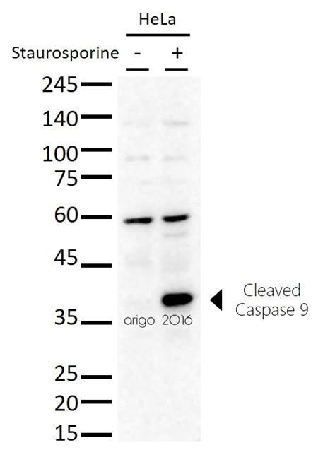 Mitochondria Caspase dependant Apoptosis 抗体 Panel (Caspase3, Caspase9 ...