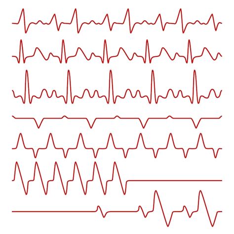 Lijncardiogrammen Of Elektrocardiogram Op Monitor Premium Vector