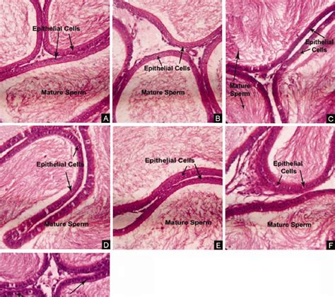 Photomicrographs Of Paraffin Embedded Handestained Rat Cauda Epididymis