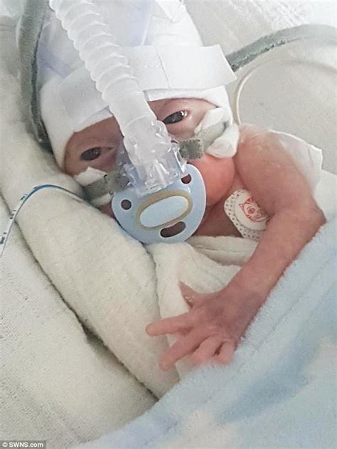 Meet The Miracle Baby Boy Born At 22 Weeks Daily Mail Online