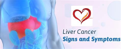 Warning Signs and Symptoms of Liver Cancer Most People Ignore..!