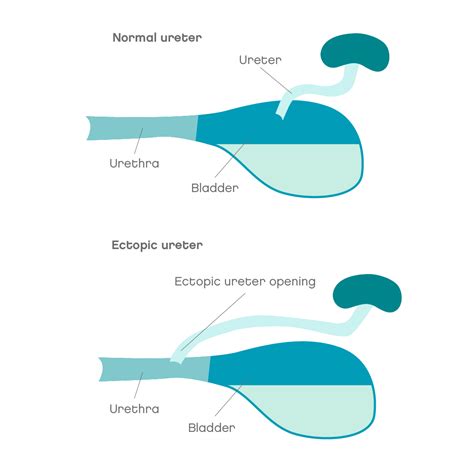 Urinary incontinence in dogs | Joii Pet Care