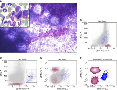 A Toluidine Blue Staining Shows Mast Cells In A Marrow Particle