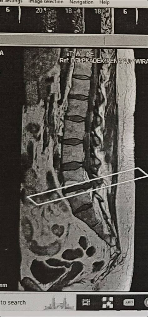 Looks like I'm being rushed into surgery after my bladder started to