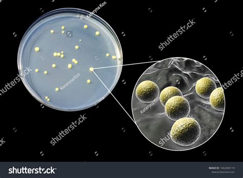 Colonies Micrococcus Luteus Bacteria On Agar Stock Illustration