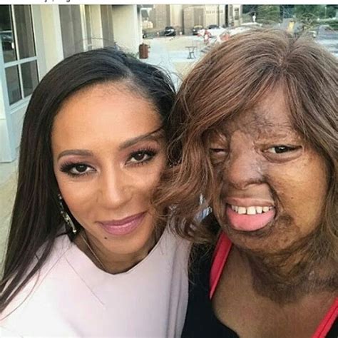 One Of The Only Two Sosoliso Plane Crash Survivors, Kechi Okwuchi With ...