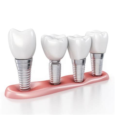 Premium Photo Human Teeth And Dental Implant Illustration Created