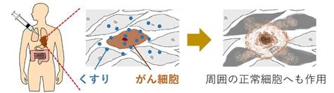 光で狙った細胞を自死させることに成功、副作用ないがん治療へ 岡山大 Science Portal 科学技術の最新情報サイト「サイエンス