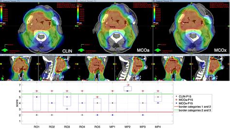 Frontiers Variations In Head And Neck Treatment Plan Quality