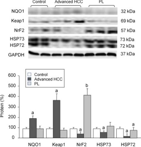 Western Blot Analysis Of Nqo Keap Nrf Hp And Hp Protein From