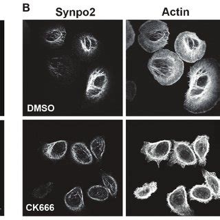 Synpo2 promotes Arp2/3-dependent lamellipodia formation. (A) Following ...