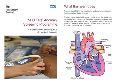 Updated Information On Congenital Heart Disease Published For Parents