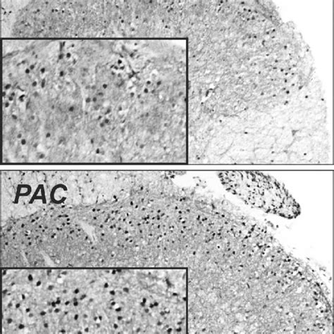 Paclitaxel Induced Upregulation Of C Fos Expression In Neuronal Nuclei