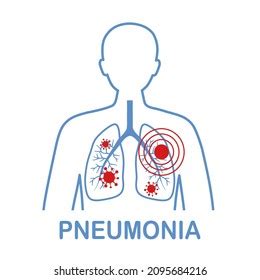 Pneumonia Disease Icon Set Human Lungs Stock Vector Royalty Free