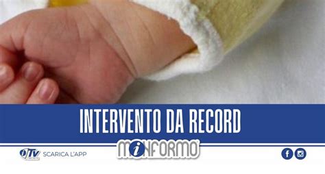 Miracolo Al Bambino Ges Di Roma Asportato Tumore Di Kg Dal Fegato