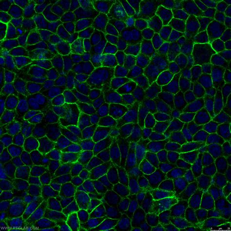 Cd44 Antibody 15675 1 Ap Proteintech