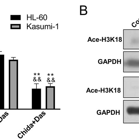 Dastinib Boosted The HDAC Inhibitory Activity Of Chidamide Leukemia