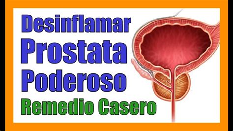 Desinflamar La Prostata De Forma Natural Remedios Caseros Para Prostata