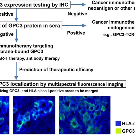 Appropriate Treatments Targeting Gpc3 Analyzing Tumor Gpc3 Expression Download Scientific