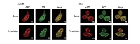 如下图 细胞转染mRFP GFP LC3病毒后给予氨基酸剥夺处理2小时后出现明显增强的自噬以及自噬流