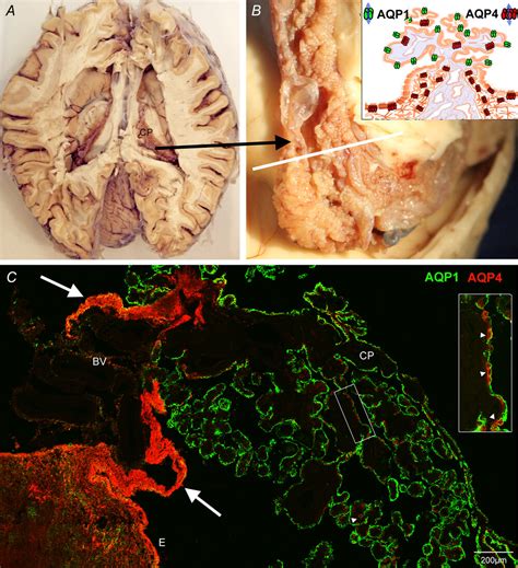 Shifting From Ependyma To Choroid Plexus Epithelium And The Changing