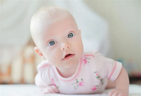 Baby Keeps Rubbing Eyes Causes How To Prevent It