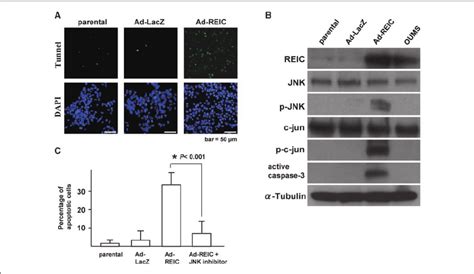 REIC Dkk 3induced Apoptosis In 211H Cells Was JNK Dependent A Tunnel