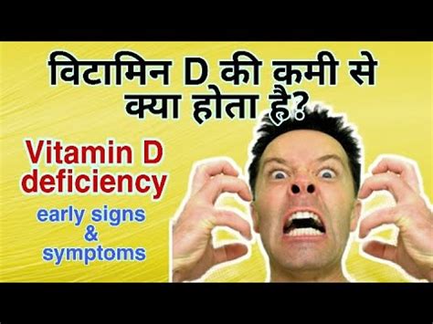 Vitamin D Deficiency In India Vitamin D Ki Kami Ke Lakshan Vitamin