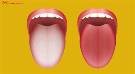 What Does Your Tongue Say About Your Health