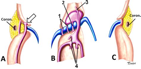 Pin em Tonan Ilustrações Médicas