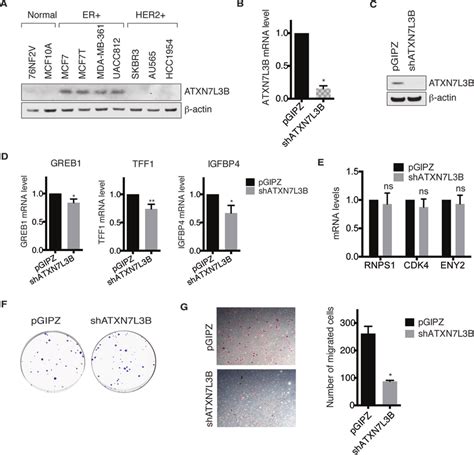 Depletion Of ATXN7L3B Inhibits Migration Of ER Positive Breast Cancer