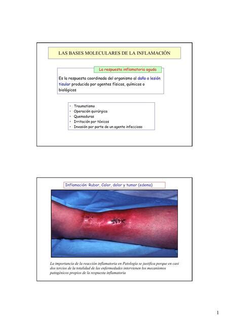 Las bases moleculares de la inflamación Anatomía Patológica Dra