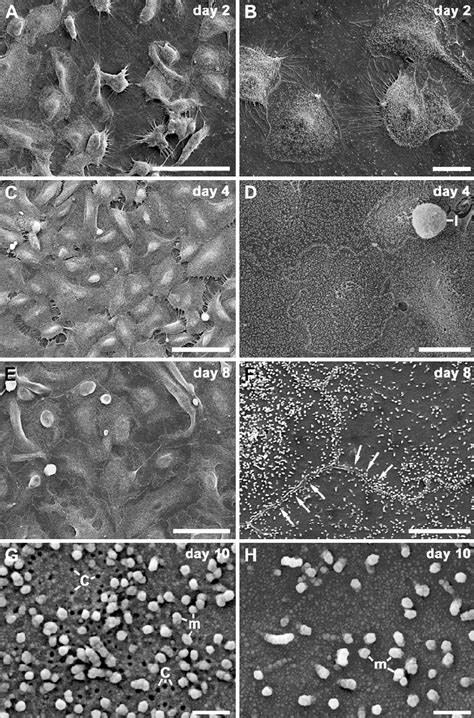 Ah Scanning Electron Microscopy Of Cultured Human Alveolar Epithelial