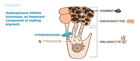 hydroquinone before after - pictures, photos