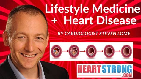 Lifestyle Medicine And Heart Disease The Power Of Lifestyle To