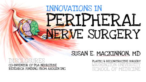 Mackinnon 2015 Uot Peripheral Nerve Surgery 032415 By Andrew Yee On Prezi