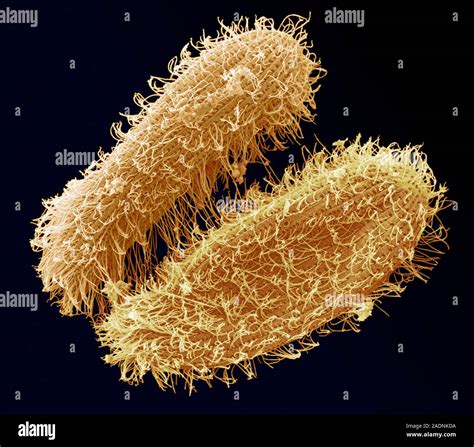 Ciliate protozoa. Coloured scanning electron micrograph (SEM) of cilliate protozoa (unicellular ...