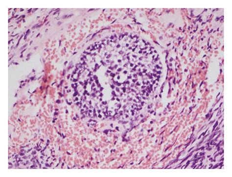 Right Ovary Histology Ovarian Tissue Comprises Multiple Ovarian