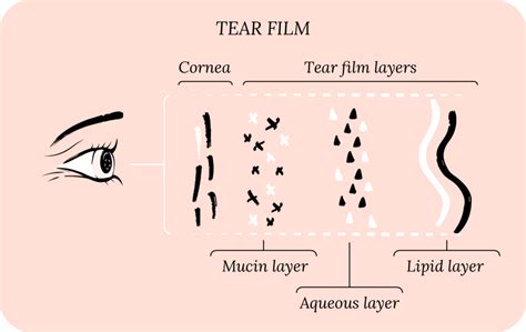 What Is Dry Eye Disease Corneacare Eyecare Made Easy