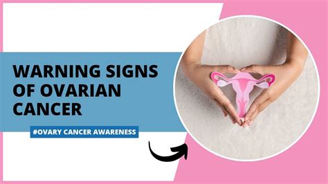 Signs Of Ovarian Cancer Warning Signs You Should Notice Ovarian Cancer Youtube