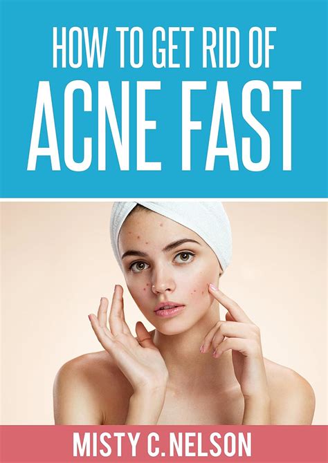 How To Get Rid Of Acne Fast Kindle Edition By Nelson Misty C Health Fitness And Dieting