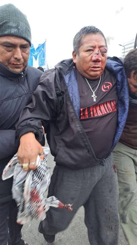 Trabajador Municipal Pierde Un Ojo En La Brutal Represion De Gerardo