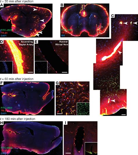 Figure From Brain Wide Pathway For Waste Clearance Captured By