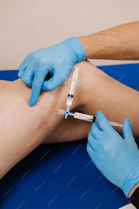 O Que Acontece Se Injetar Ar Na Veia - Escleroterapia injetando na veia varicosa ou aranha na perna para ...