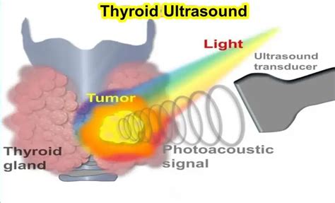 How Does It Look Thyroid Ultrasound Images Normal Best Cpt 2024