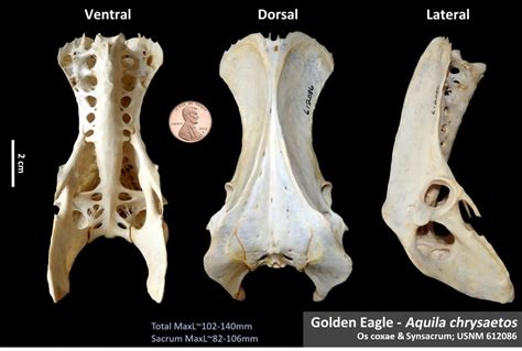 Bones Osteoid Bone Identification