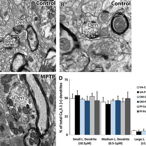 Em Immunoperoxidase Localization Of Cav Labeling In Dendrites Of